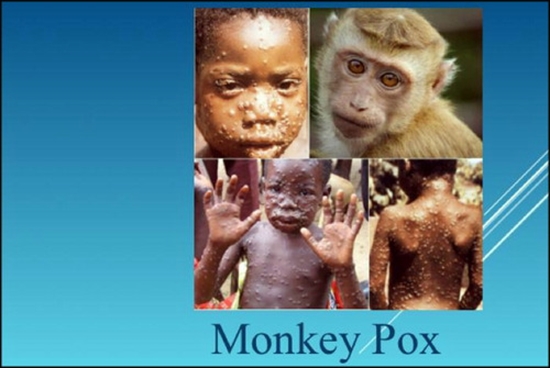 برگزاری وبینار تشخیص، درمان و مراقبت بیماری آبله میمون (Monkey Pox) توسط گروه بیماری‌های واگیر معاونت بهداشت  